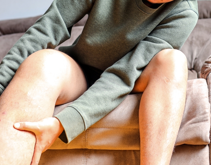 Leg Pain and Swelling Due to Varicose Veins | Causes & Treatment