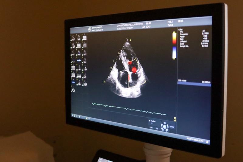 Vascular diagnostic ultrasound